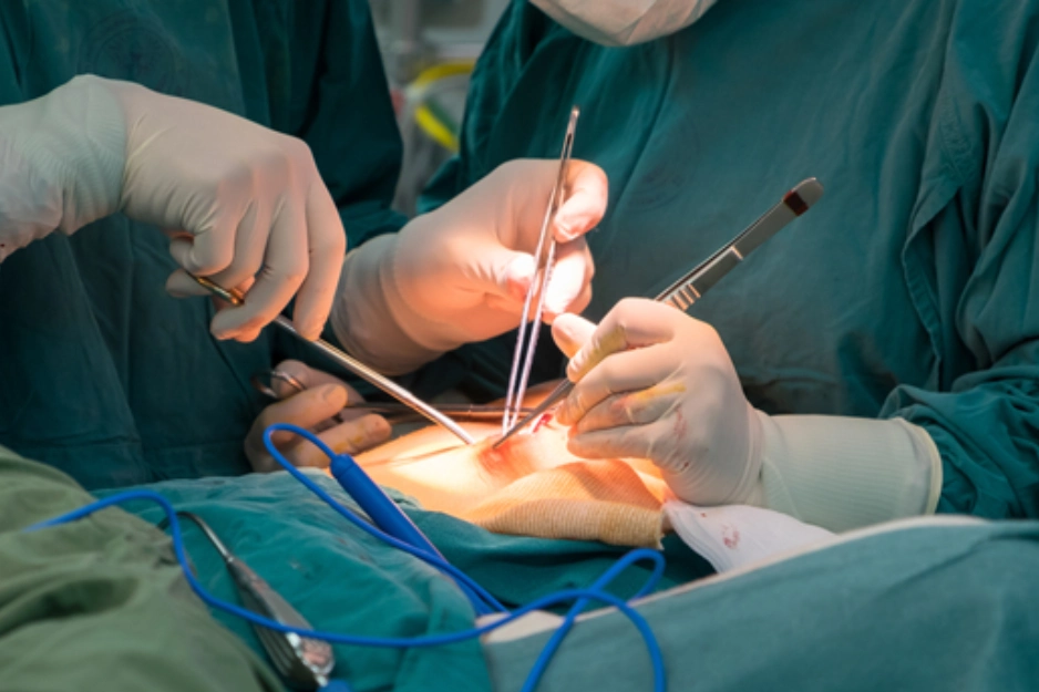 General Surgery